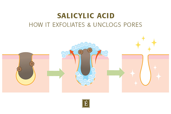 Cómo el ácido salicílico exfolia y destapa los poros
