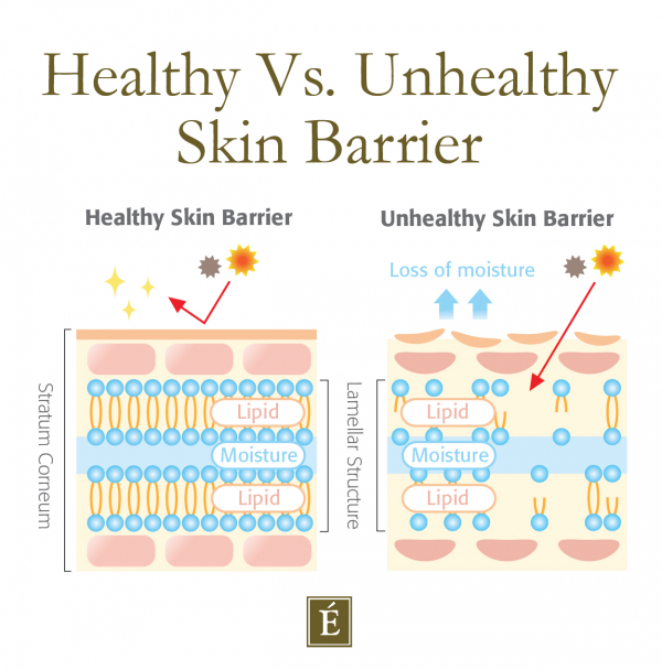 Tabla de barrera de la piel saludable vs. no saludable